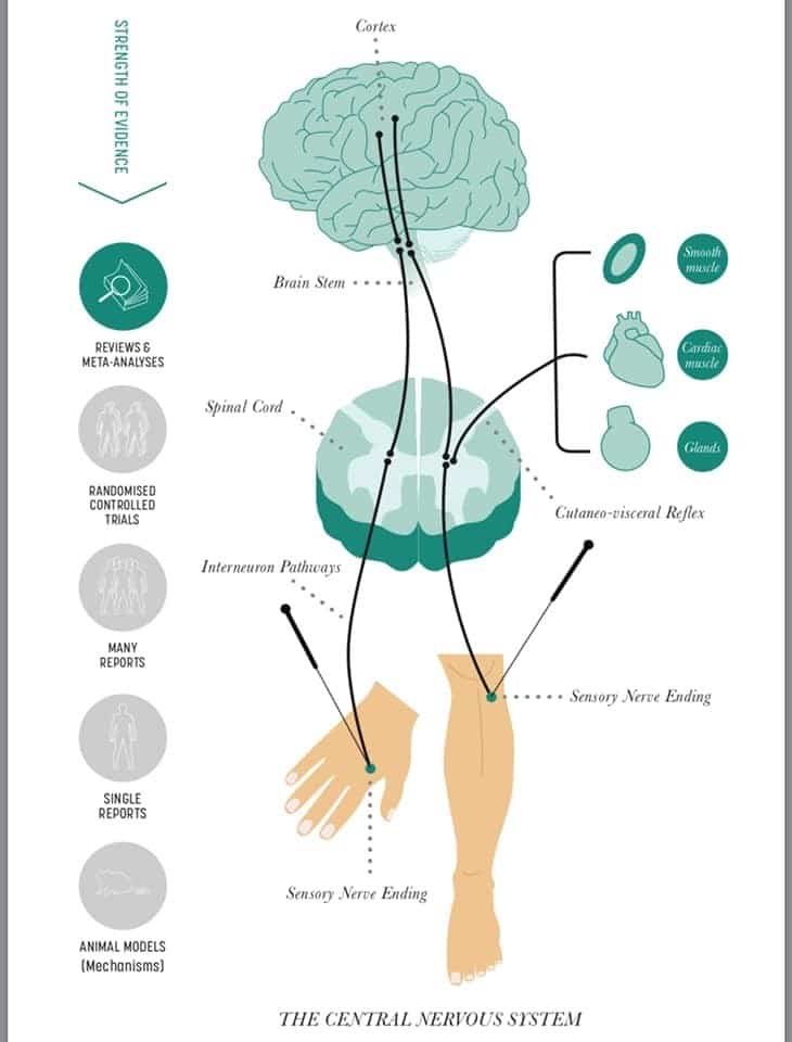 acupuncture 5