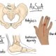 Rheumatic Pain