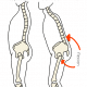 Hip & Knee Arthritis