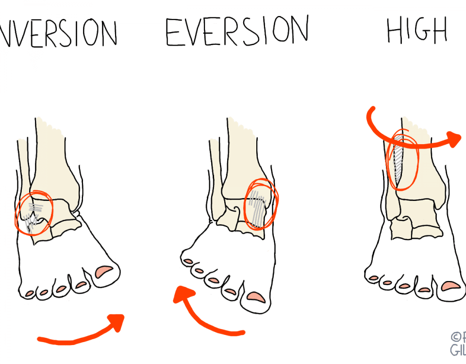 Sports Injuries