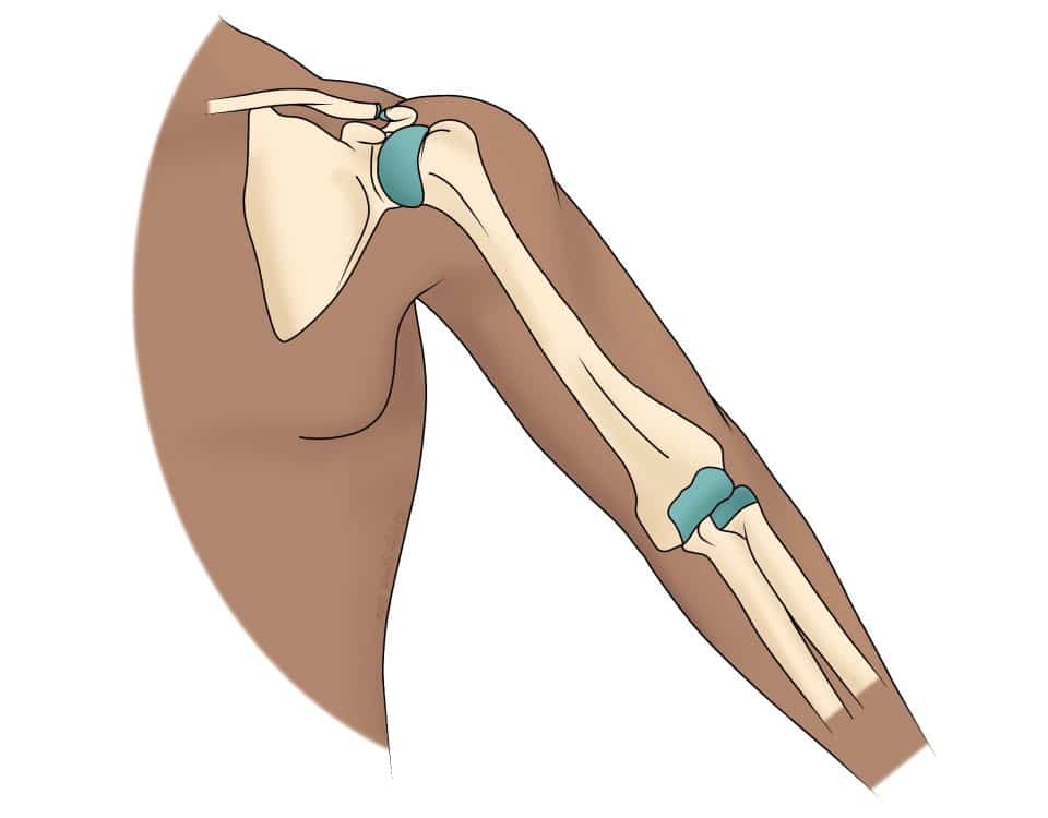Shoulder or Elbow Pain