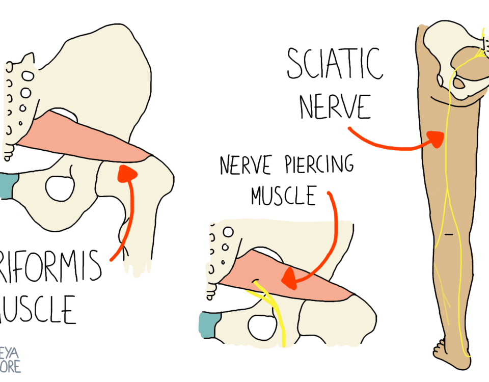 Piriformis Syndrome