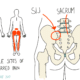 SIJ Pain and Pregnancy