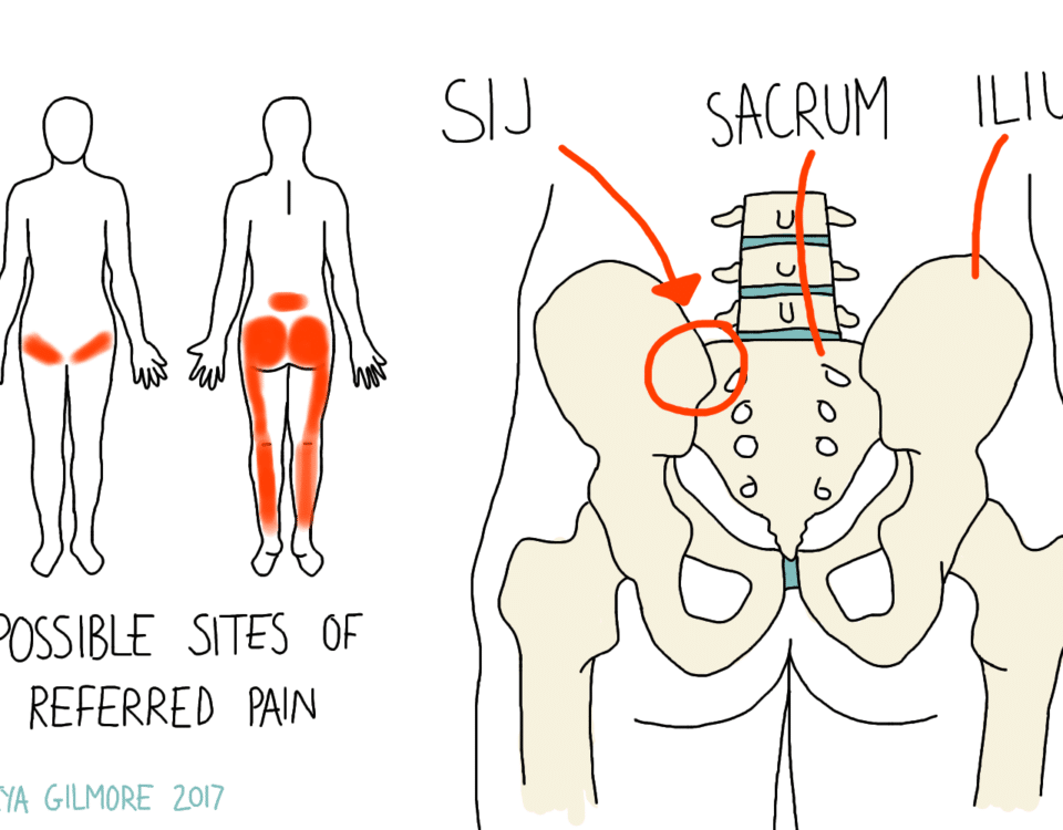 SIJ Pain and Pregnancy