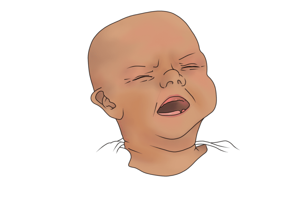 Baby with Colic