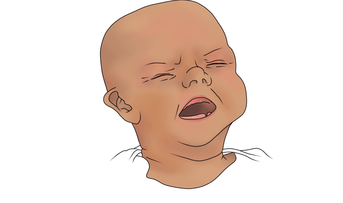 Baby with Colic