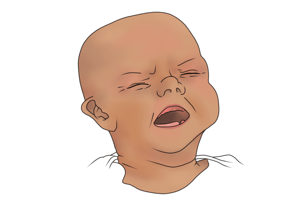 Baby with Colic