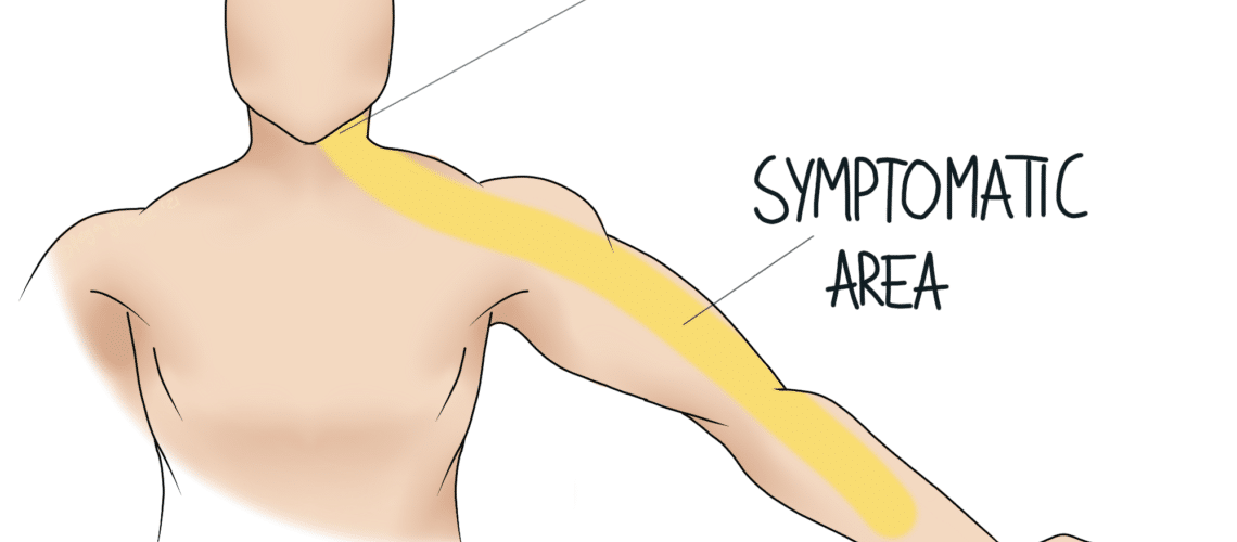 Referred Pain