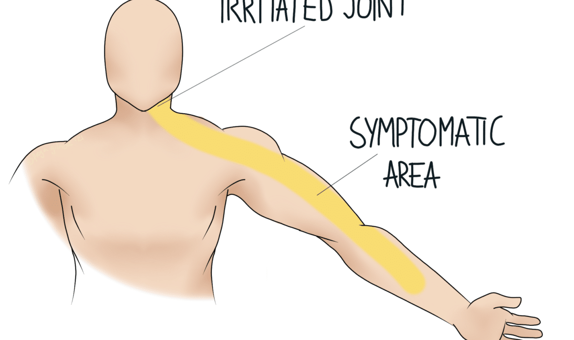 Referred Pain