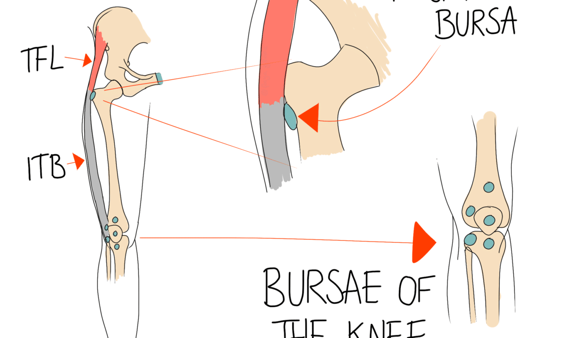 Bursitis