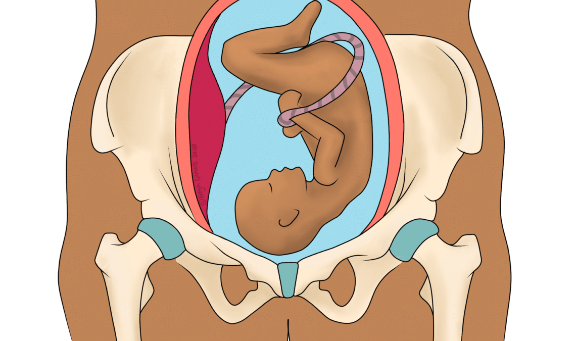 SPD and PGP: pregnancy joint pain