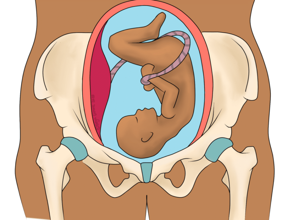 SPD and PGP: pregnancy joint pain