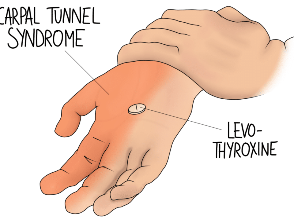 Hormones and Pain