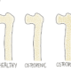 Osteoporosis and Osteopenia