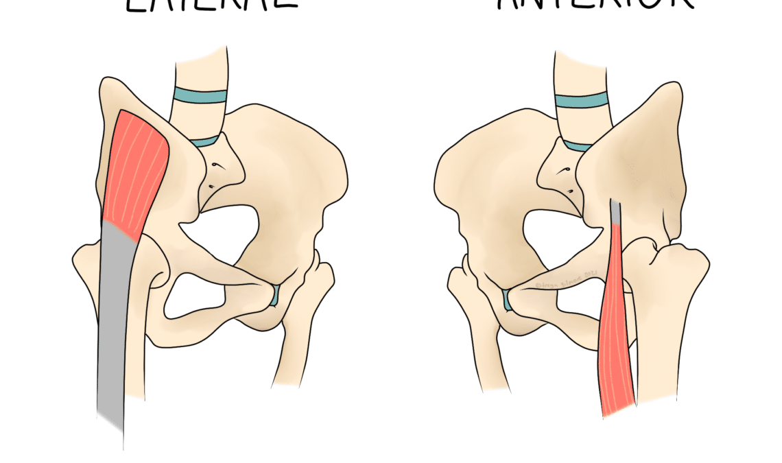 Snapping Hip Syndrome