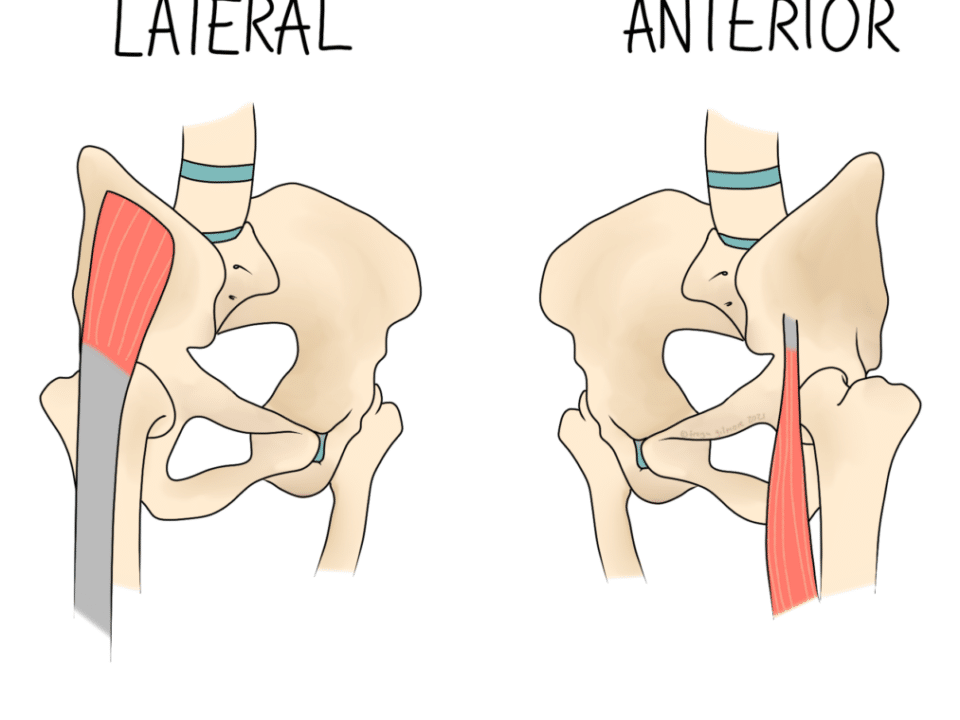 Snapping Hip Syndrome