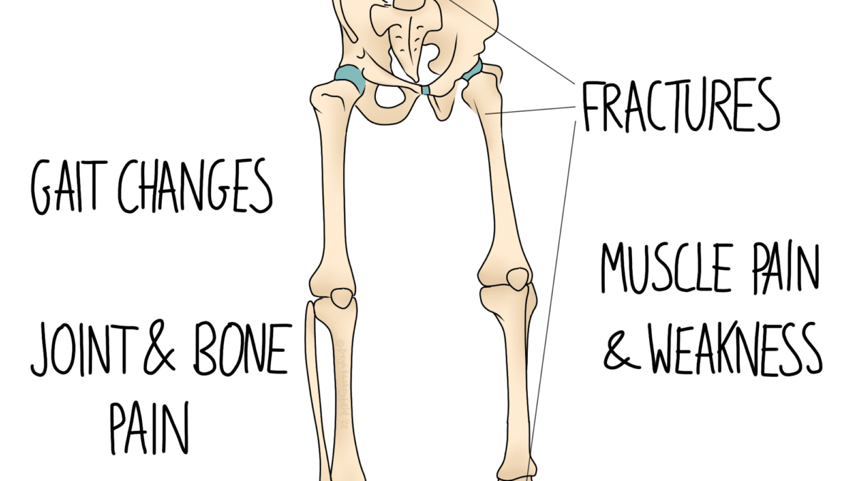 osteomalacia