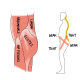 Lower cross syndrome