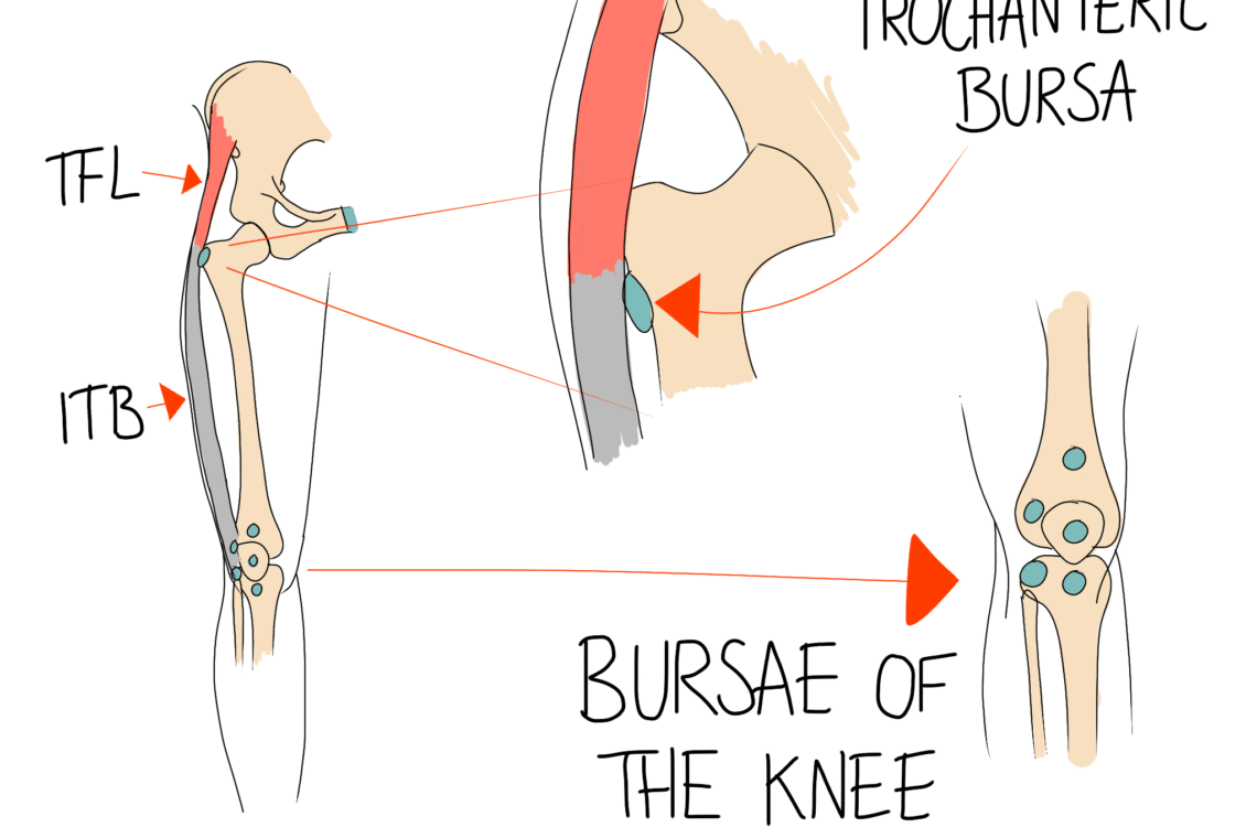 Diagram illustrating the hip and knee anatomy, highlighting the iliotibial band (ITB), tensor fasciae latae (TFL), trochanteric bursa, and knee bursae with labeled arrows.