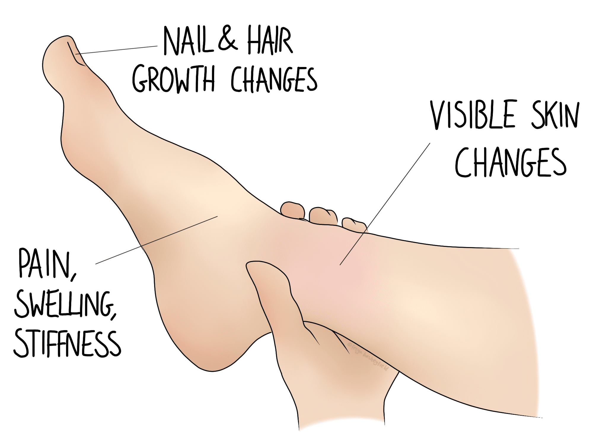 A foot held by a hand shows annotations for "Nail & Hair Growth Changes," "Visible Skin Changes," and "Pain, Swelling, Stiffness" to illustrate possible symptoms or conditions.