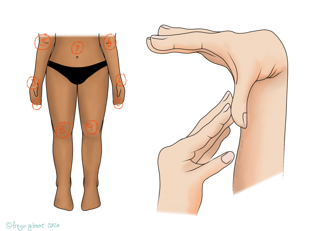 A diagram shows a standing person with numbered points on joints and abdomen, alongside a hand demonstrating hypermobility. ©Freya Gilmore 2020.