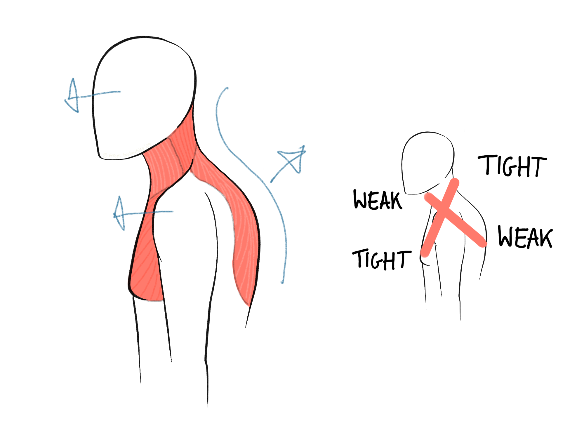 A stylized human figure showing neck and shoulder musculature. Left side highlights red muscle areas with arrows indicating direction. Right side emphasizes imbalances with "TIGHT" and "WEAK" labels.
