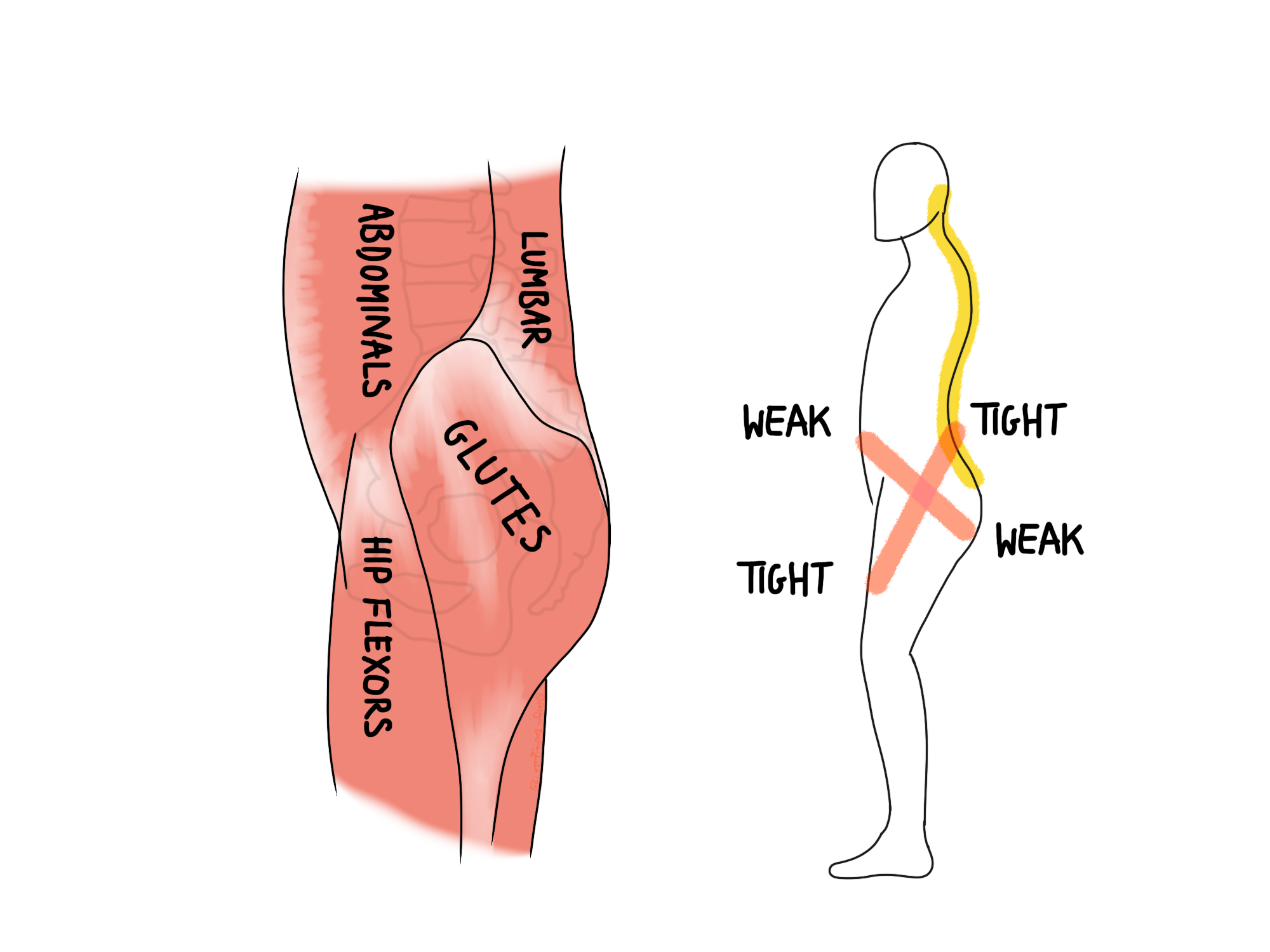Muscles labeled as abdominals, lumbar, glutes, and hip flexors are shown. Next to it, a diagram of a person with arrows and labels: "tight" and "weak" indicate muscle imbalances.