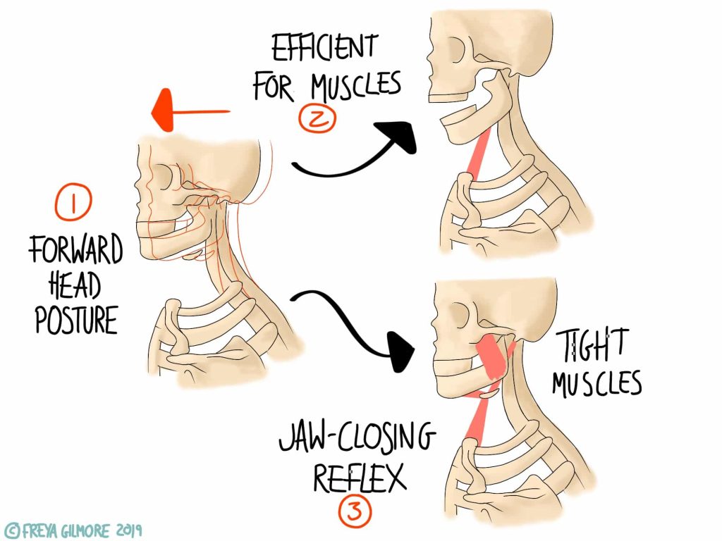 The effects of tension on head position and the jaw