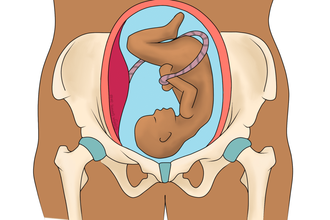 Fetus curled inside a womb, with umbilical cord wrapped around, centered within a pelvis illustration.