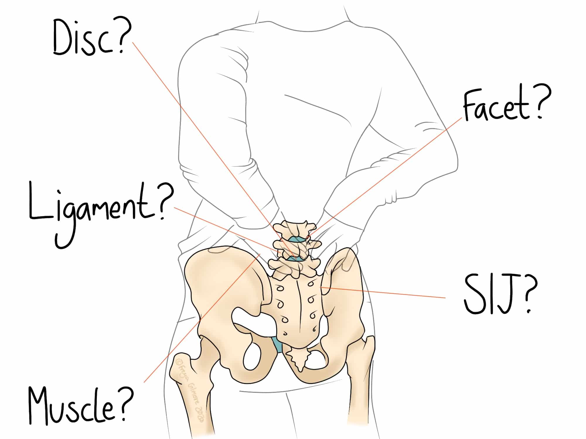 A person holds their lower back with an overlay of the pelvic anatomy labeled: "Disc?," "Facet?," "Ligament?," "SIJ?," and "Muscle?" Indicating possible sources of pain or issues.