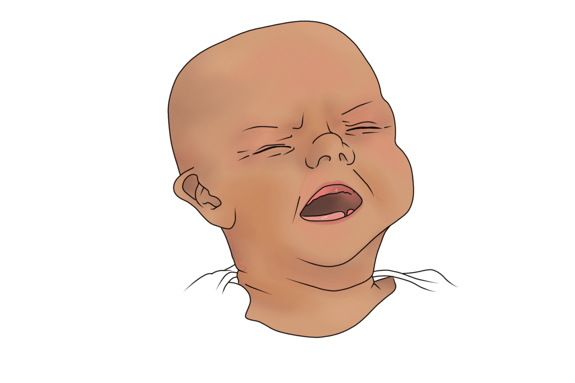A baby with closed eyes and open mouth, appearing to cry, against a plain white background.