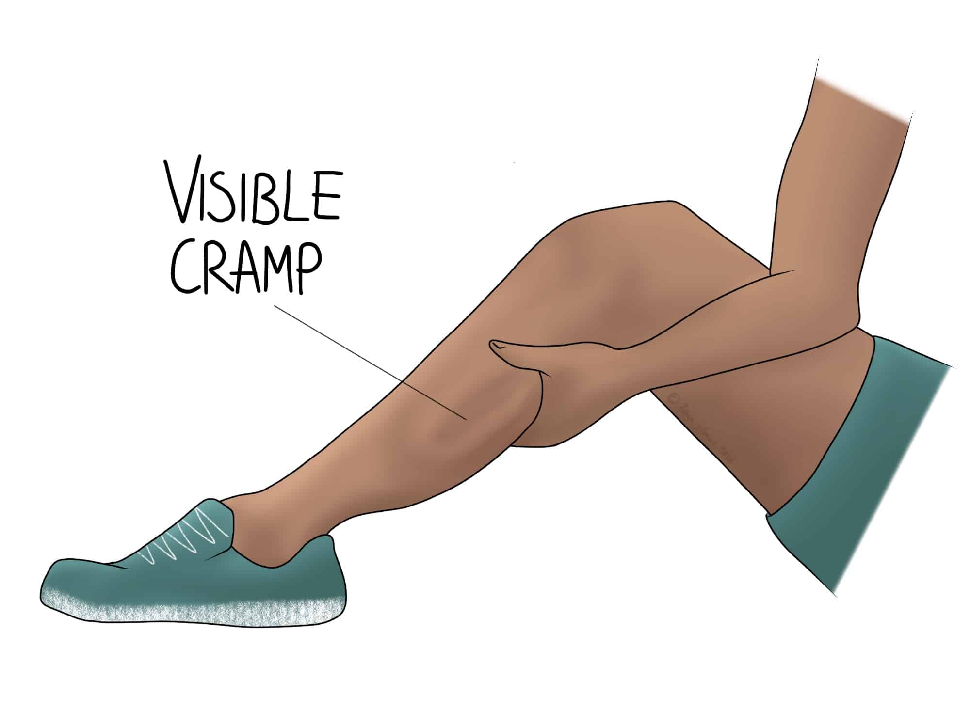 A person holds their leg, experiencing a cramp. "Visible cramp" text indicates the location. The leg is bent, wearing a teal shoe and shorts, set against a white background.
