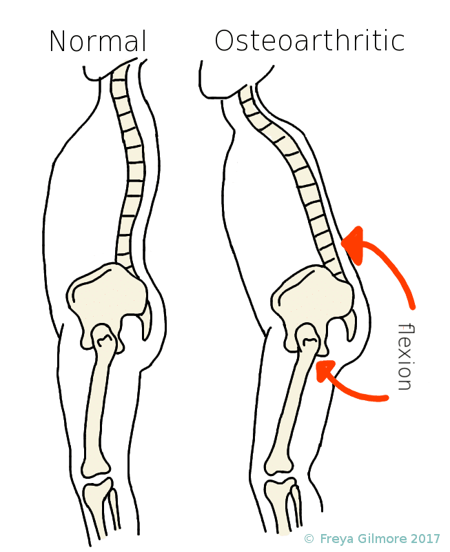 Two skeletal side views show a "Normal" and an "Osteoarthritic" hip. The latter indicates reduced flexibility with red arrows labeled "flexion." © Freya Gilmore 2017.