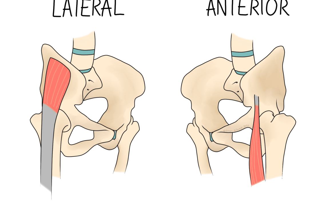 Two illustrations compare hip anatomy from lateral and anterior views. Both show a pelvis with hip joint bones and highlighted muscles. Labels: "LATERAL" and "ANTERIOR" indicate perspectives.
